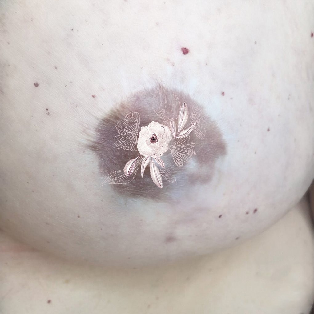 Nipple-areola complex dermapigmentation - for beautiful breasts